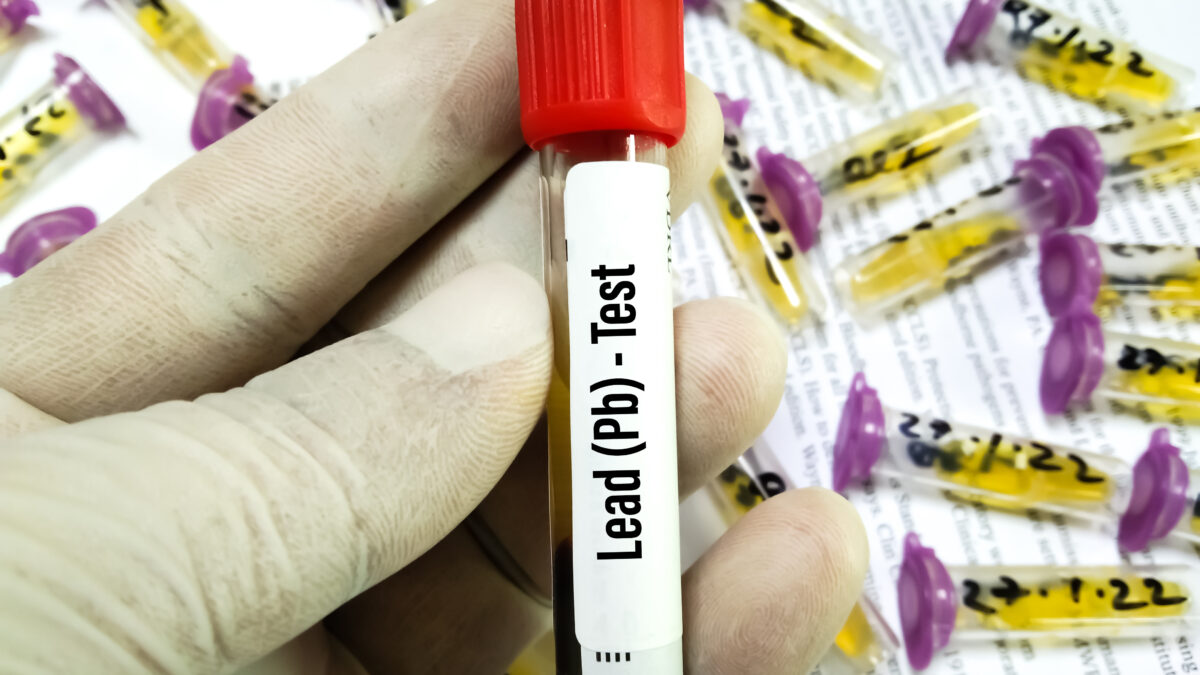 Blood sample tube for Lead (Pb) test at medical laboratory. To diagnosis lead toxicity